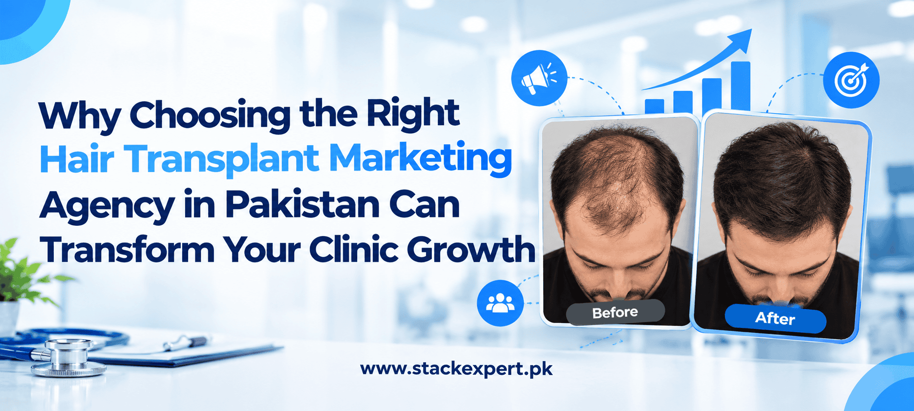 Why Choosing the Right Hair Transplant Marketing Agency in Pakistan Can Transform Your Clinic Growth